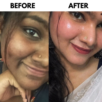 "QUWWAT" Organic Skin Whitening Cream ( 100% Gurranted Results )